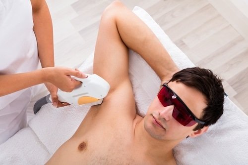 5 Benefits of Laser Hair Removal You Should Know